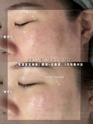 -KISS U 国际美学