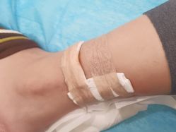 -海涛医疗美容·面部抗衰·注射美鼻