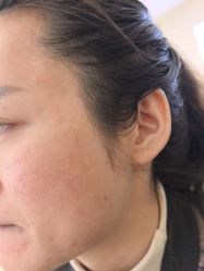 -长沙雅美医疗美容医院
