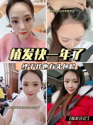 -雍禾植发全国连锁