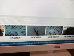 -丝客富脱发养发头皮馆
