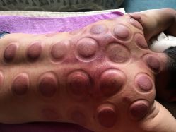 -悦艾堂·中医拔罐减肥·美体艾灸连锁