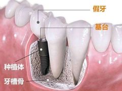 -团圆口腔·种植中心(锦江院区)