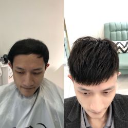 -发饰美男士增发补发假发定制店