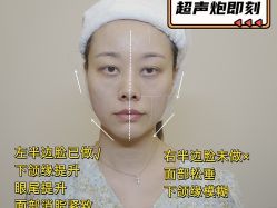 -上海伊莱美医疗美容医院