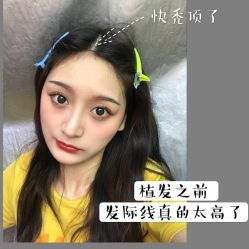 -碧莲盛·不剃发植发