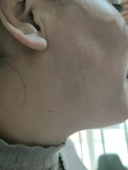 -痣清宫祛斑祛痣连锁店