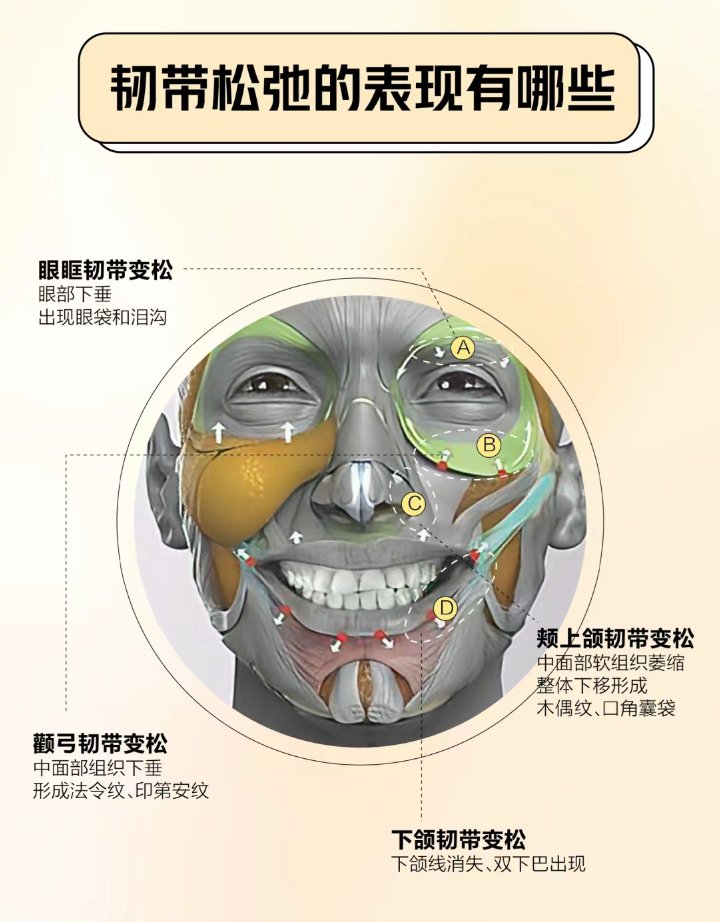 提颧肌示意图图片