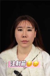 -烟台曙光医疗美容医院