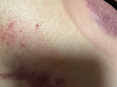 -沈师傅盲人按摩工作室(密三小区店)