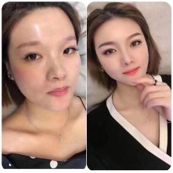 -郡艺医疗美容·微整·眼鼻吸脂