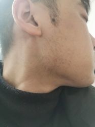 体验后-重庆军科整形美容医院