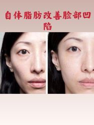 -圣嘉新医疗美容医院