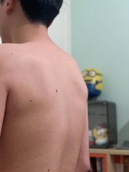 -清疣美疣·痣·斑净肤中心