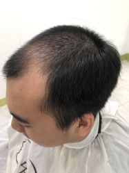 -发饰美男士增发补发假发定制店