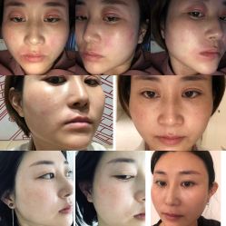 -黎蓓露·徒手骨雕蛋白抗衰·调肤管理