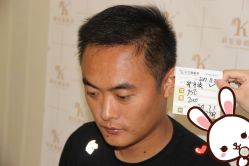 点击看大图 -大麦微针植发丨全国连锁