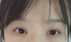 体验后-西美医疗美容门诊部