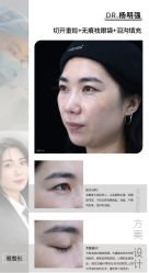 -丰联丽格医疗美容·联合丽格眼整形中心