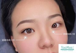 -YooMee优美智能科技美肤机构