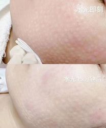 -广州健丽·去眼袋医疗美容机构