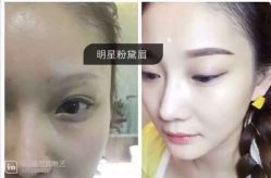iphone_upload_pic-MIVI·纹眉半永久野生眉