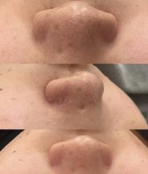 -SKIN79皮肤管理中心