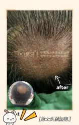 -熙朵美学植发·连锁品牌