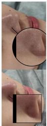 -SKIN79皮肤管理中心