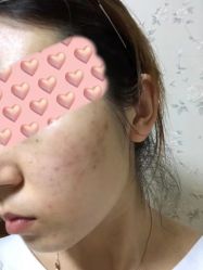 -初颜品佑肌肤管理