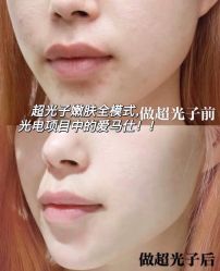 -温州伯思立医院