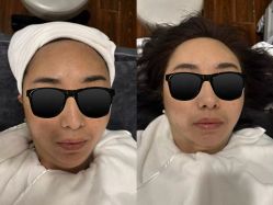 -黎蓓露·徒手骨雕蛋白抗衰·调肤管理