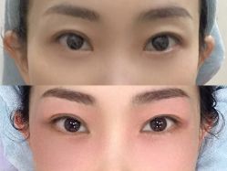 体验前-小忠丽格医美