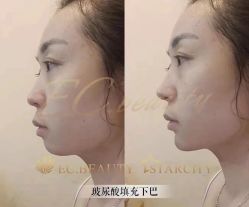 点击看大图 -慕拉美甲美睫皮肤管理