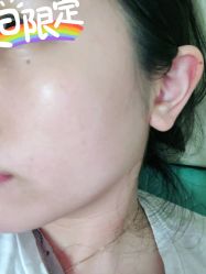 体验后-广州美莱医疗美容医院
