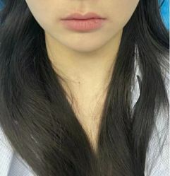 体验前-上海伊莱美医疗美容医院