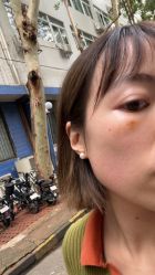 -广州美莱医疗美容医院