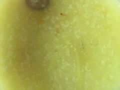 虫草花鸡皇粥-华辉拉肠(广园店)