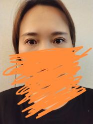 体验后-深圳鹏爱悦心医疗美容医院
