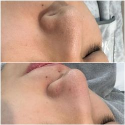 体验前-skin79皮肤管理中心