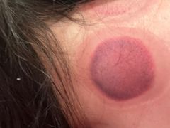 -御一坊盲人推拿(青年路店)