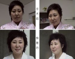 -新雅韩整形美容医院