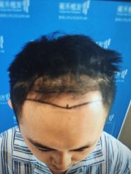 -雍禾植发全国连锁