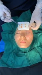 -广州健丽·去眼袋医疗美容机构