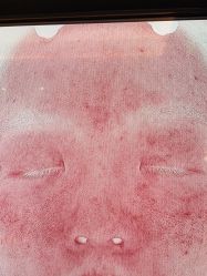 -苑苑vbeauty科技美容SPA