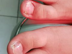 -新甲连锁灰指甲·甲沟炎·鸡眼(黑龙江路店)