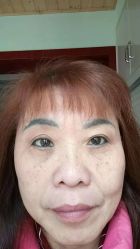 -天津健丽·去眼袋医疗美容机构