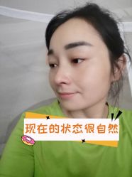 -素美医疗美容·西南眼鼻整形·修复基地