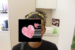 -大麦微针植发丨全国连锁