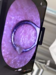 -凡碧诗毛孔清洁收细